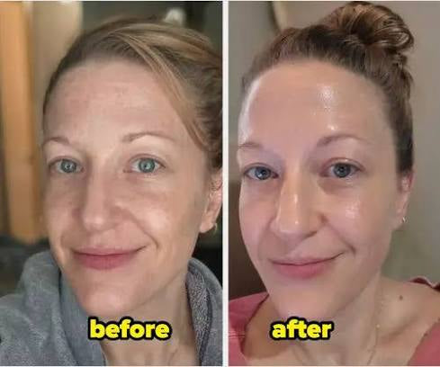 Exfoliating Black Rice Ampoule 60ml